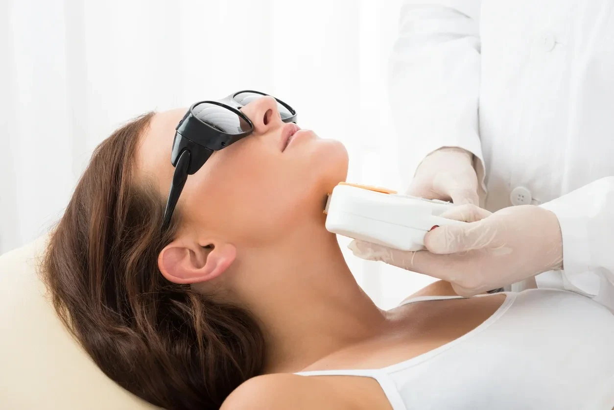 Laser hair removal treatment on neck
